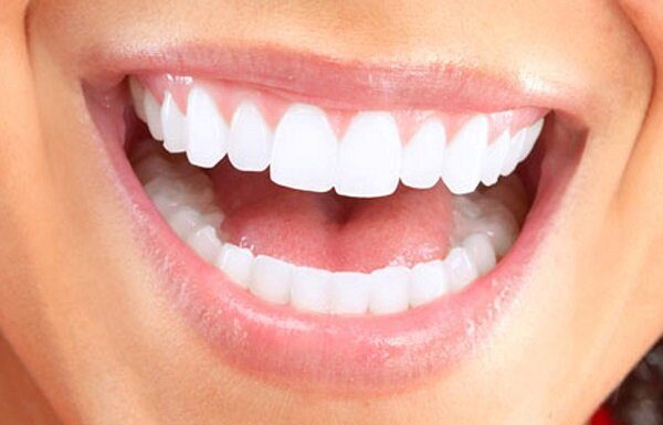 زیبایی لبخند بدون آسیب به دندان – خبرگزاری مهر | اخبار ایران و جهان