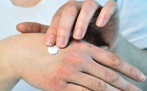 راهکارهای طب ایرانی برای حفظ سلامت پوست و بدن در فصل سرد – خبرگزاری مهر | اخبار ایران و جهان