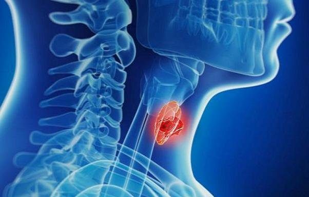 افزایش آمار تشخیص بدخیمیهای تیروئیدی – خبرگزاری مهر | اخبار ایران و جهان