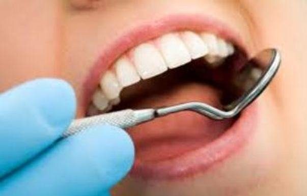 راهکار رفع بوی بد دهان در ایام روزهداری – خبرگزاری مهر | اخبار ایران و جهان
