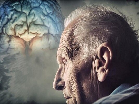 مصرف نمک میتواند مشکلات حافظه را تشدید کند – خبرگزاری مهر | اخبار ایران و جهان